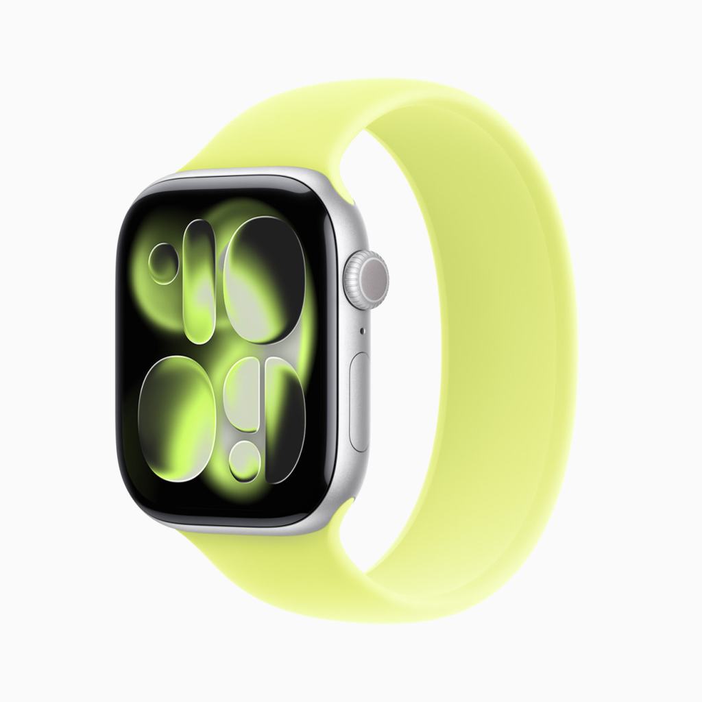 Apple Watch Series 11 with a light yellow band and a vibrant display showcasing a modern watch face design.